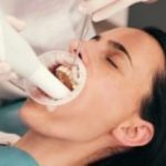 How Often Do You Need Dentist Teeth Cleaning Done?