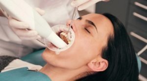 How Often Do You Need Dentist Teeth Cleaning Done?